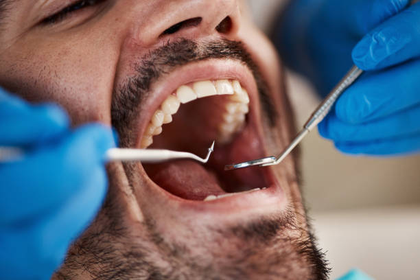 Best Emergency Dentist for Knocked-Out Tooth in Lake Camelot, IL