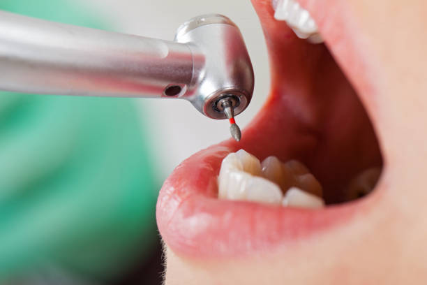 Best Holiday Emergency Dentist in Lake Camelot, IL